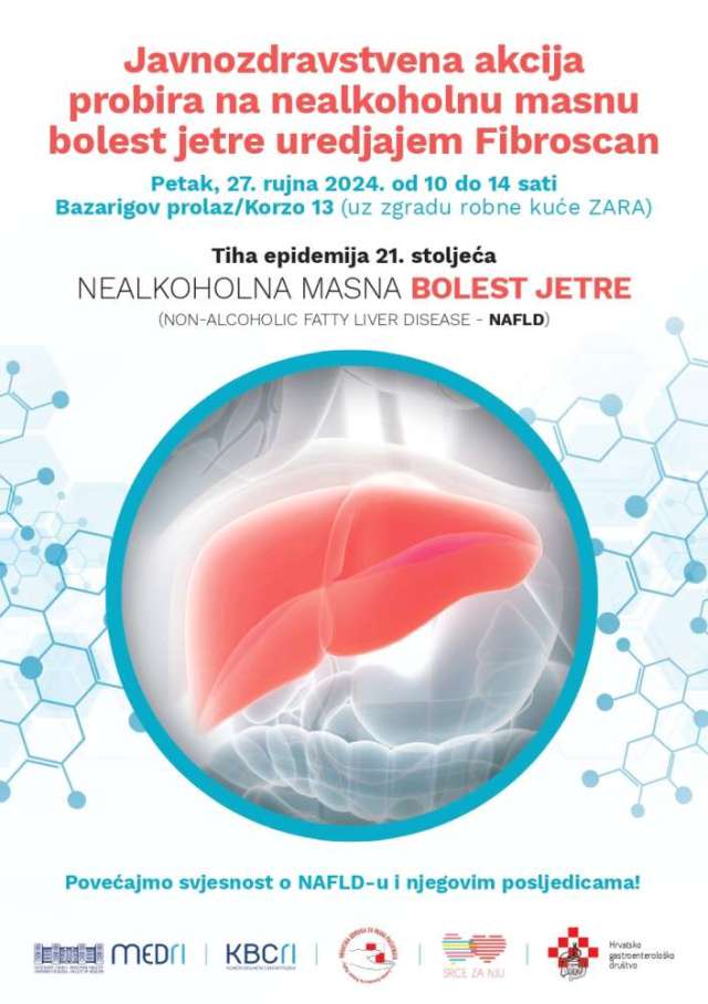 Akcija - Nealkoholna masna bolest jetre